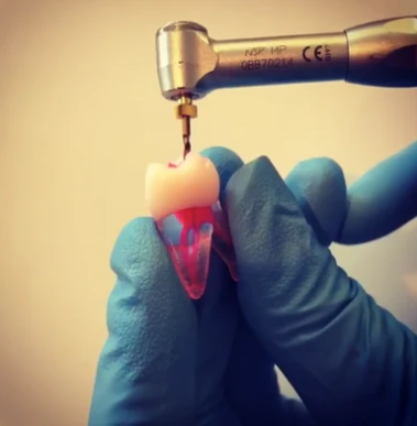 Waldent Premium Taper Gold Rotary Files 25mm