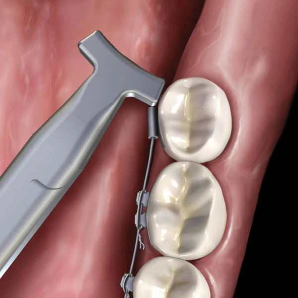 Waldent Orthodontic Hammer Head NiTi Pliers 10/115