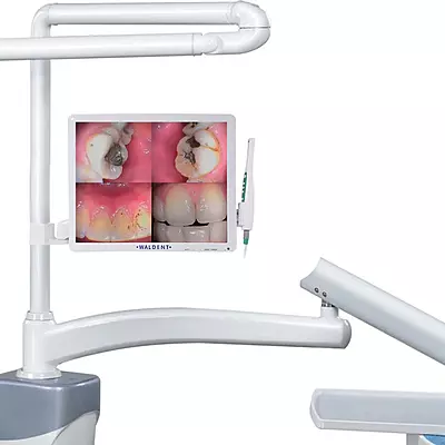 Waldent Intraoral Camera Monitor Clamp Waldent Intraoral Camera Monitor Clamp
